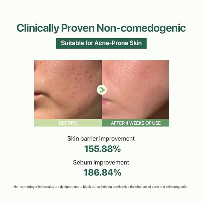 Le Nubele Azulene Cica Ampoule Soothes Acne Prone and Sensitive Skin, Azulene 700ppm, Centella Asiatica, Panthenol, Non-Comedogenic, Reduce Redness, Korean Skin Care, 50ml/1.06 fl.oz.