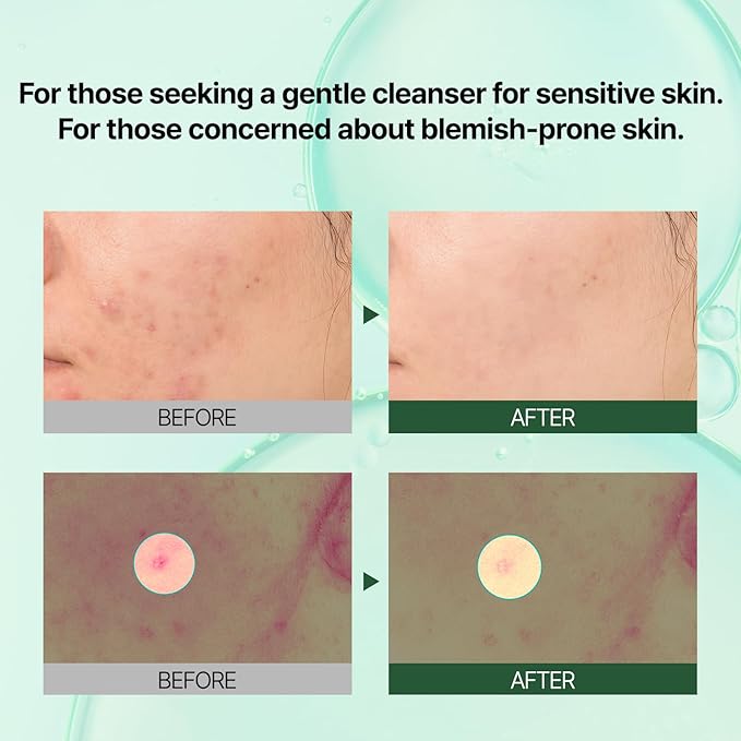 PONGDANG Pore Deep Clean Bubble Cleanser 5.11 fl.oz | Facial Foam for acne-prone skin | Zero Irritation | Sebum Control & Hydrating Wash | Korean Skin Care
