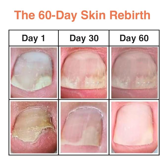 Fermented Nail Oil for Cuticle & Nail Repair | Vegan K-Beauty Serum with Herbal Extracts | Natural Strengthening & Moisturizing Formula for Brittle, Dry Nails | Nourishes, Smooths, Restores | 8ml
