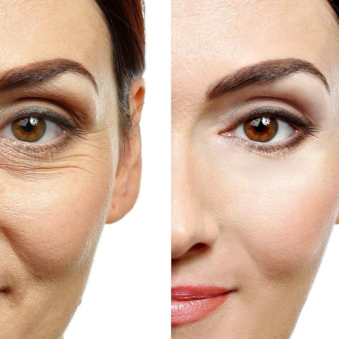 Retinol Moisturizer Cream 2.5% for Face & Eye Area - Anti-Aging Formula with Hyaluronic Acid, Vitamin E, Green Tea - 1.7 Fl Oz