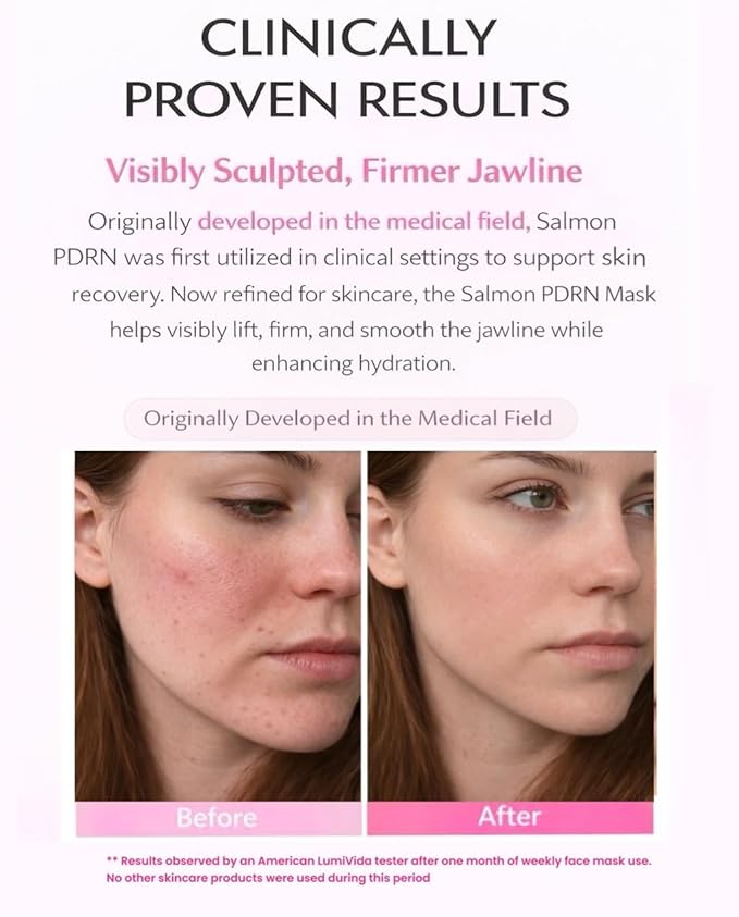 Salmon DNA PDRN Anti-Aging Jelly Gel Mask | Overnight Firming & Hydrating Face Mask for Elasticity & Glow | Korean Skincare with Niacinamide, Peptides & Hydrolyzed Collagen | 4 Pack