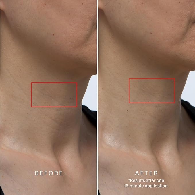 Karuna Collagen Neck & Chest Hydrogel Mask 1-Pack | Firming & Hydrating K-Beauty Masks with Collagen, Peptides & Niacinamide | For Wrinkles & Sagging Skin | Cruelty-Free