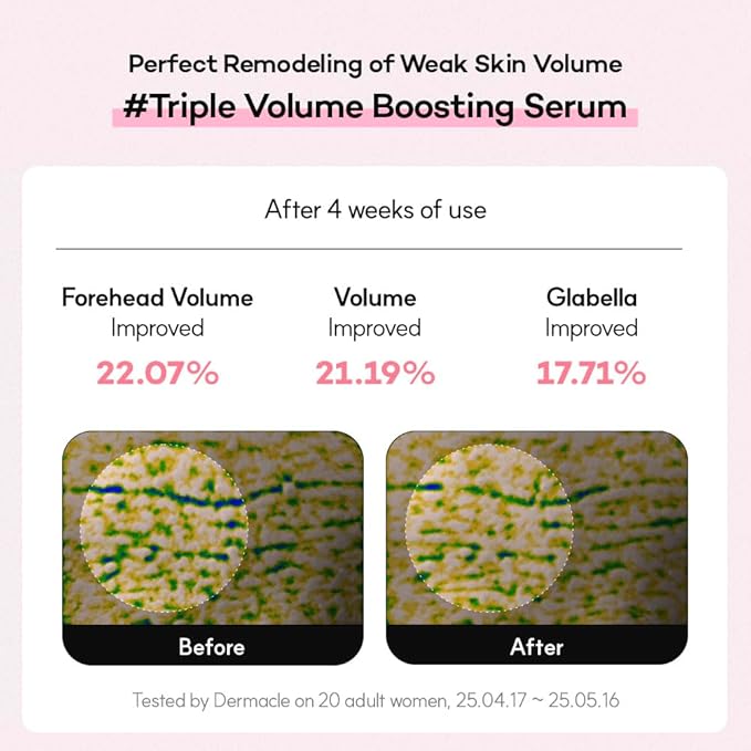 Vegan PDRN Firming Bouncy Boost Serum - Black PDRN, Fermented Yeast-Derived | Ultra-Low Molecular (≤80bp) Formula | Smooth, Resilient-Looking Skin | Vegan Collagen, Bakuchiol & Retinol (30ml)