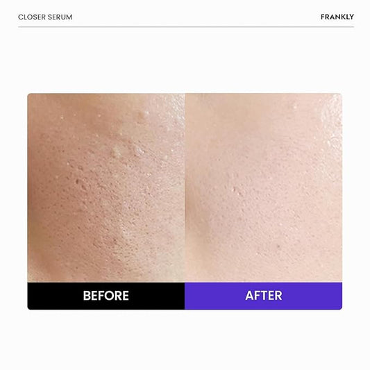 FRANKLY Closer Serum | Pore Minimizer Serum | 9 Peptides, Vegan Collagen, Adenosine, PHA | Korean Pore Minimizer for Glass Skin, Anti-Aging, Hydration, Elasticity | 1.01 fl oz