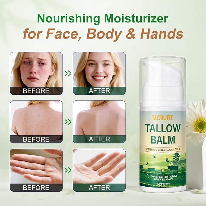 Beef Tallow Balm, 100% Grass Fed Beef Tallow, Whipped Moisturizer for Sensitive Skin, Handmade All-Natural Moisturizer for Soft And Smooth Skin (7 Oz, Unscented)