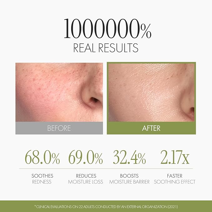 Artichoke Biome Calming Facial Ampoule, Redness-Relief Serum for Sensitive Skin, Soothing Face Hydrator with Artichoke Leaf & Centella Asiatica, Vegan K-Beauty, 1.69 fl oz (50 ml)