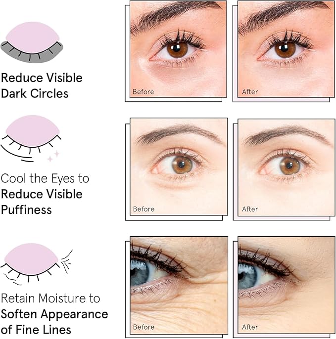 grace & stella Under Eye Mask - Reduce Dark Circles, Puffy Eyes, Undereye Bags, Wrinkles - Gel Under Eye Patches, Bulk Gifts for Women - Vegan Cruelty-Free Self Care (72 Pairs, Gold, Pink, & Blue)