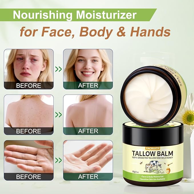 Organic Grass-Fed Beef Tallow & Raw Honey Balm – Handmade Whipped Moisturizer for Face & Body, Soothes Eczema, Rosacea, Dry & Sensitive Skin – Unscented, All-Natural, Chemical-Free (6 Packs / 12oz)