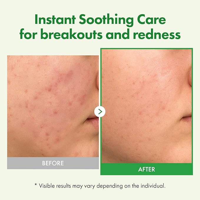 TOSOWOONG Ultimate Korean Moisturizer Set: 70% Cica for Redness, 9-Type Hyaluronic for Dryness, Low Molecular Collagen for Elasticity - Day & Night Care Kit