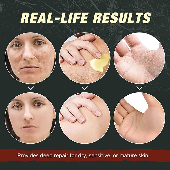 100% Grass-Fed Tallow, Organic Castor & Frankincense Oil Face Balm - Age-Defying Moisturizer for Sensitive & Dry Skin, Repairs Skin Barrier, Handmade for Face & Body, 4.2oz