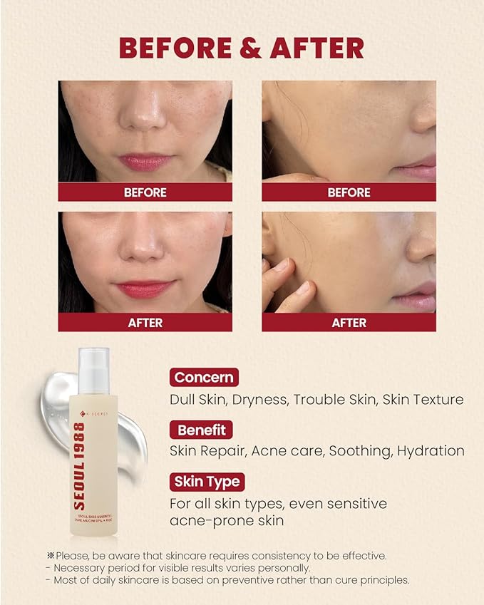 K-SECRET SEOUL 1988 Snail Mucin 97% Essence – Concentrated Yet Lightweight Formula Infused with 97% Snail Mucin | Soothing & Fast-Absorption Facial Serum | Korean Skincare, 100ml / 3.38 fl oz