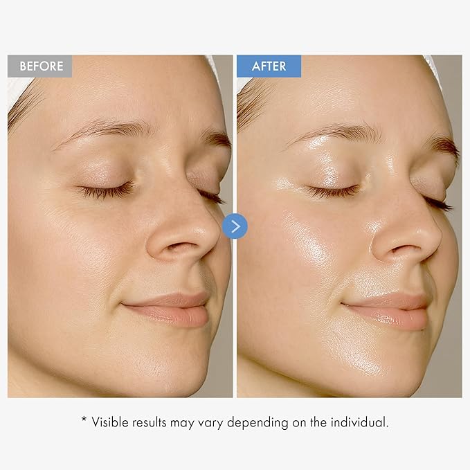 TOSOWOONG Ultimate Hydration & Skin Renewal Duo: Hyaluronic Acid 9 Cream & 9 Peptide Skin Booster Serum for Radiant Complexion