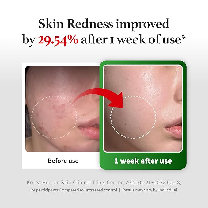 Peptide Derma Relief Cream – EGF, CICA & Panthenol Barrier Repair Face Moisturizer, Korean Skincare for Sensitive Skin, Soothing & Calming Redness, Hydrating Face Cream, Unscented,1.35 Fl Oz