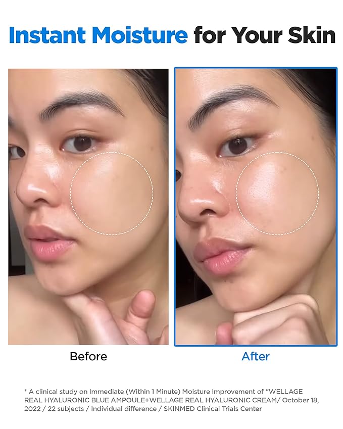 WELLAGE Real Hyaluronic Blue Ampoule 100, Korean Hydrating Serum for Face, Fragrance Free Hyaluronic Acid Deep Moisturizing Serum with Panthenol, PDRN for Sensitive Dry Skin Moisturizer, 2.54 Fl Oz_R