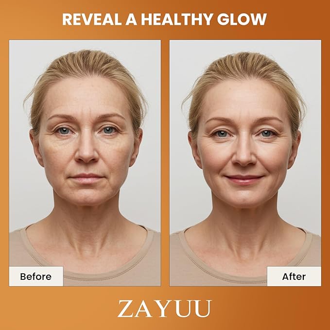 Super Korean Vitamin C Face Serum: 23% Pure Vitamin C + Hyaluronic Acid, Vitamin E & Ferulic Acid – Anti-Aging Serum for Wrinkles, Dark Spots & Mature Skin – Korean Skincare