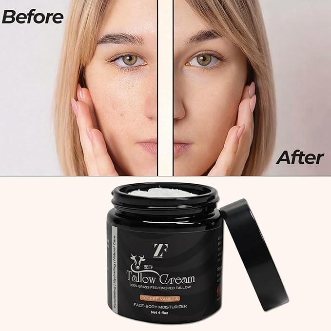 ZF 100% Grass Fed Beef Tallow for Skin Care - Face + Body - Natural Organic Lotion - Whipped Moisturizer for Sensitive Skin 4 FL. oz. (Coffee Vanilla)