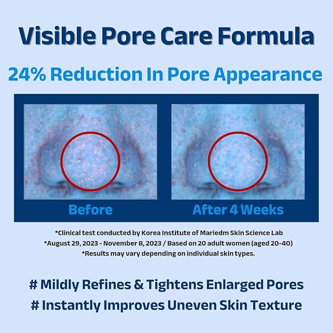 ACNIOME Pore-Care Gel Moisturizer, Lightweight Oil-Free Daily Hydration for Oily & Sensitive Skin, With Salicylic Acid & Hyaluronic Acid, Non-Sticky, Perfect Under Makeup, 1.69 fl oz