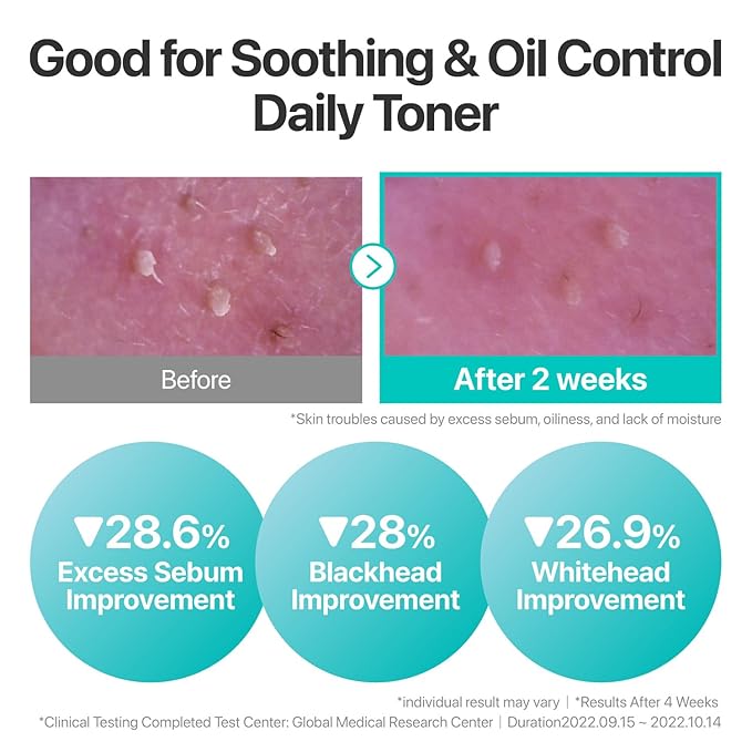 numbuzin No.1 Toner | Pure-Full Calming Herb Toner | Breakouts, Redness, Excess Oil Control | Centella Asiatica, Heartleaf, Licorice Root | Acne-Prone, Sensitive Skin | 10.14 fl. oz.