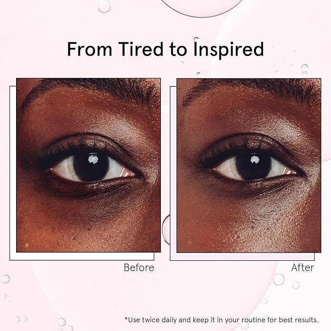grace & stella Under Eye Brightener with Cooling Metal Rollerball - Ceramide & Caffeine Eye Serum for Puffy Eyes - Travel Size Toiletries - Vegan Skincare (15ml / 0.51floz)