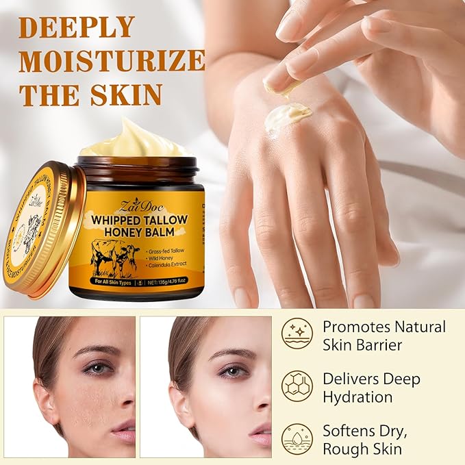 Whipped Honey Balm with Manuka Honey & Calendula, Multi-Purpose Salve for Face & Hands, Grass-Fed Formula, Deep Moisturizing for All Types, 4.76oz