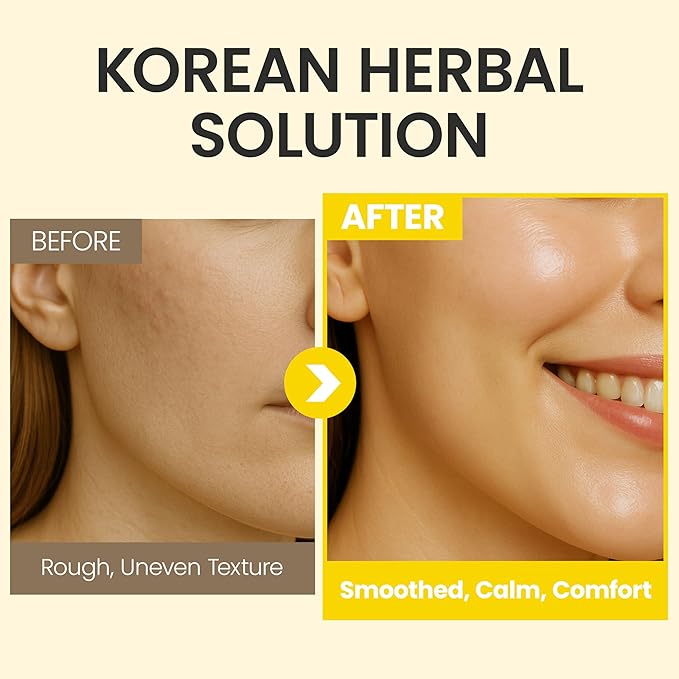 ORIGIN Face Moisturizer Cream - Korean Daily Moisturizer with Propolis & Coix Seed Extract complex - Deep skin Hydration & Soothing for Dry, Sensitive Skin [ 2.71 fl oz ]