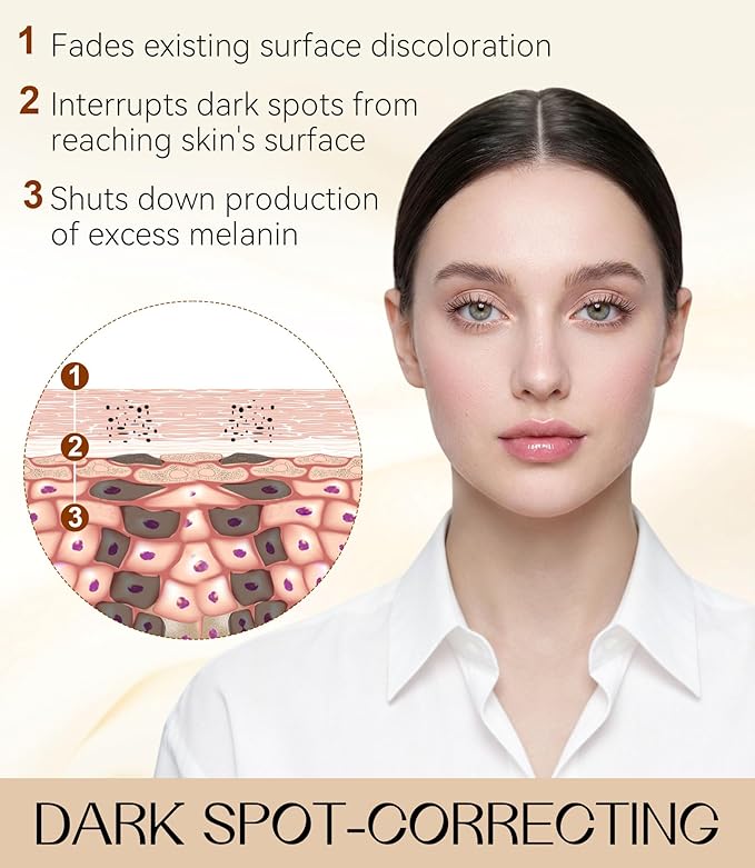 TJE Dark Spot Remover for Face & Body, Dark Spot Corrector with Niacinamide, Fade Cream for Hyperpigmentation, Sun Spots, Age Spots & Melasma, 1.7 fl oz, Skincare Gift for Women, Women’s Day Gift