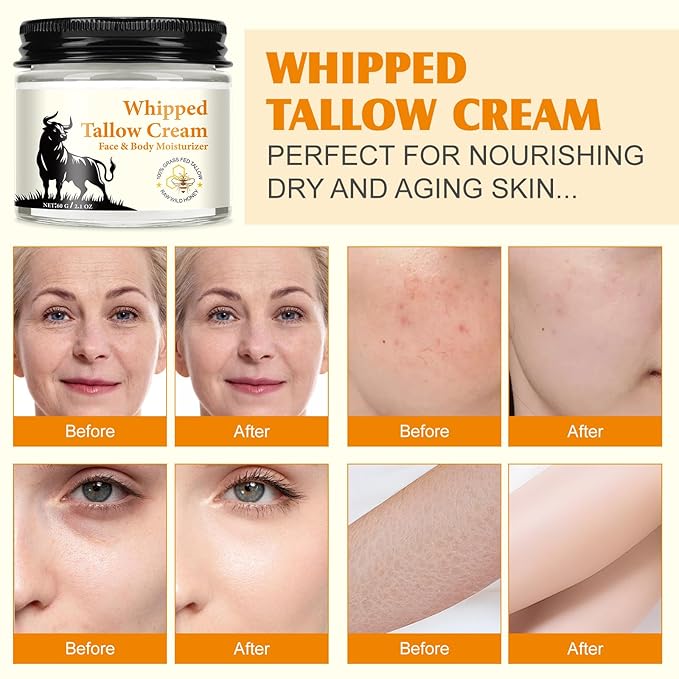 Acorn + Oak Organic Whipped Tallow Moisturizer 2.1oz – Grass Fed Beef Tallow For Skin, Face & Body, Unscented Skin Care for Women Girls