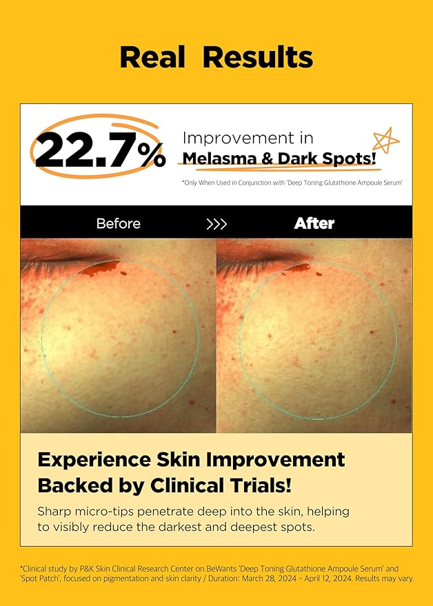bewants Deep Toning Glutathione Spot Patch – Micro Tip Patches for Skin Elasticity, Texture & Blemish Care, 9 Patches