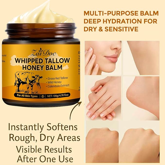 Whipped Honey Balm with Manuka Honey & Calendula, Multi-Purpose Salve for Face & Hands, Grass-Fed Formula, Deep Moisturizing for All Types, 4.76oz