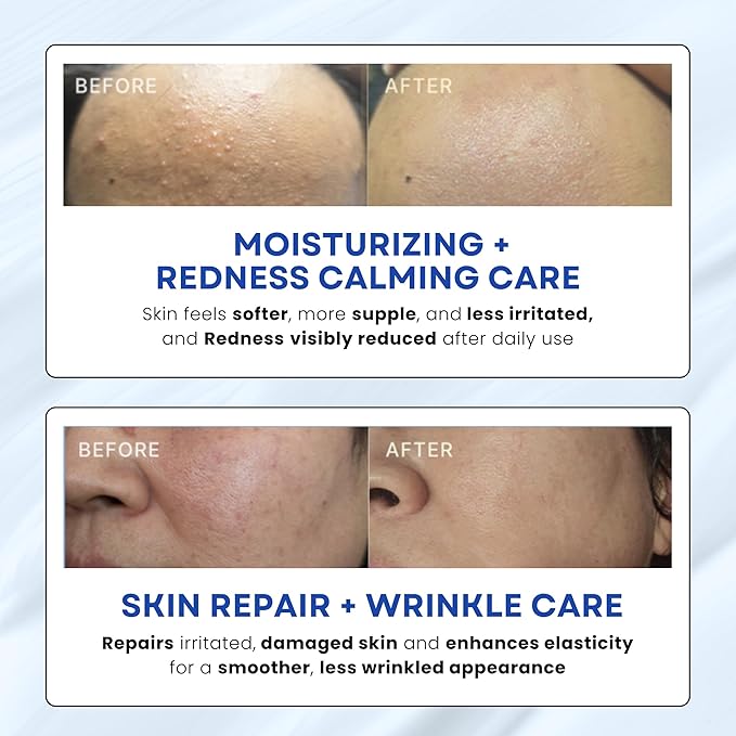 EGF Cica Panthenol Ceramide Repair Cream. Korean moisturizer for damaged, irritated, sensitive skin. Centella asiatica, niacinamide, madecassoside. K Beauty 1.69 fl oz