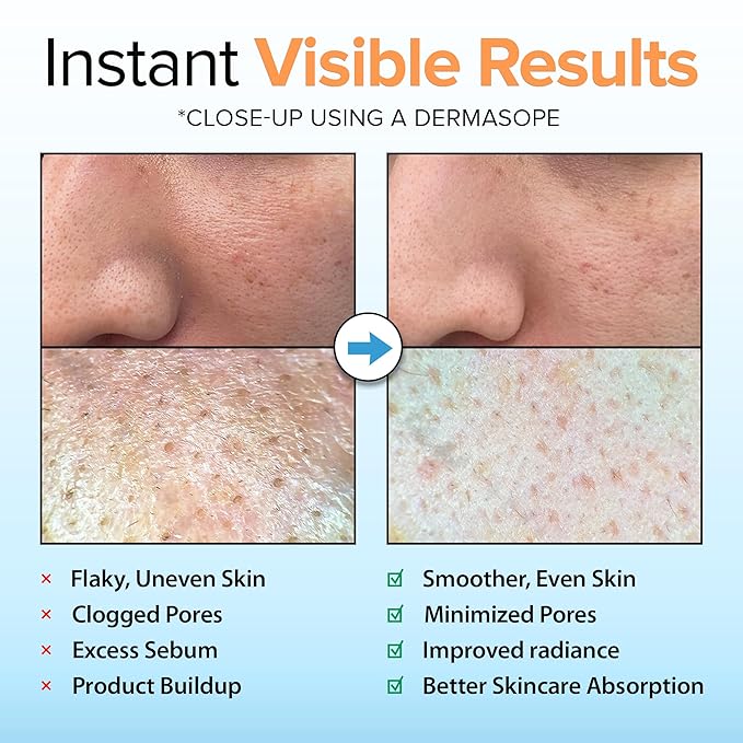 Ebanel Brightening Peeling Gel with Cotton Cellulose, Rice, Papaya, Centella, Hyaluronic Acid for Face and Body, Gentle Exfoliating Face Scrub Gel Peel Wash, Deep Pore Cleanser Minimizer Exfoliator