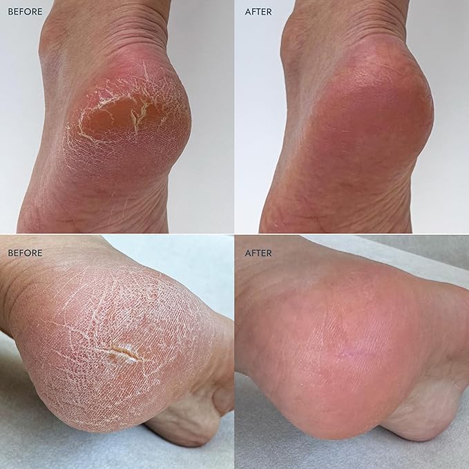VOESH Solemate Heel Repair Balm, Moisturizer, Heel Repair, Balm for Rough & Cracked Heels, K-Beauty Korean Skincare, Foot Care For Men & Women - Lavender