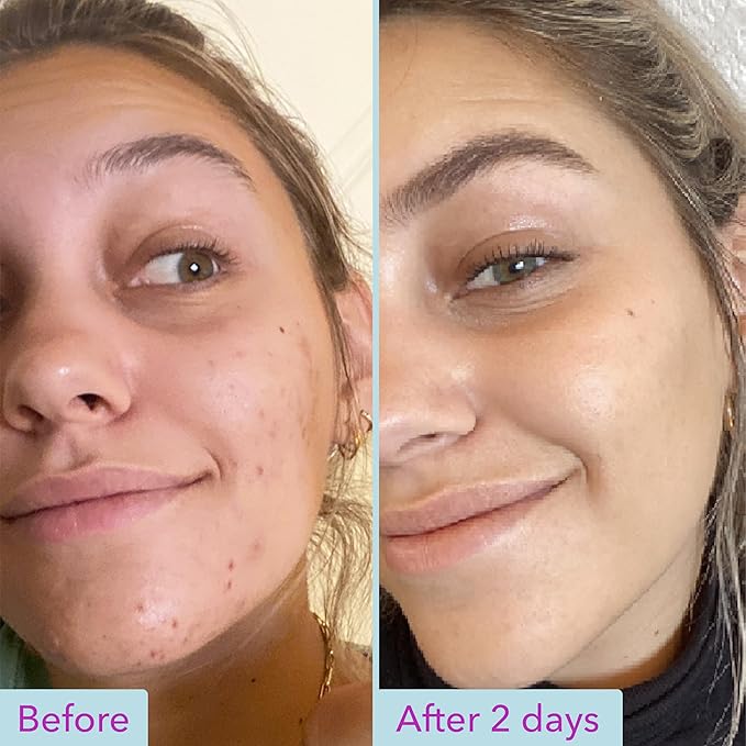Good Molecules Niacinamide Brightening Toner - Toner for Face with Niacinamide and Arbutin for Skin Tone Balancing- Pore Minimizer, Facial Skin Care