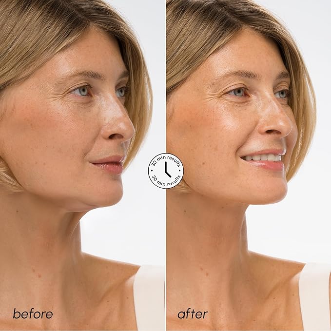 MAREE V Line Lifting Mask with Hyaluronic Acid – Deep Collagen Face Mask for Women – Jawline Shaper Facial Masks with Retinol – Tightening & Firming Neck Lift Tape – Double Chin Strap for Face Lift