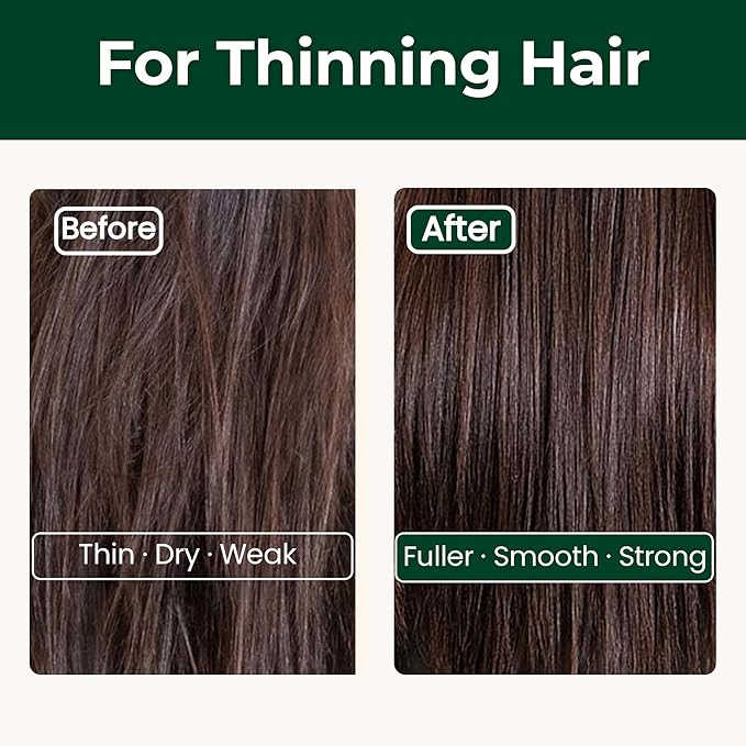 Black Bean Shampoo Bar for Thinning Hair – Volumizing K-Beauty Solid Cleanser with Biotin & Charcoal for All Hair Types – Sulfate Free, Vegan – Made in Korea – 3.52 oz / 100 g
