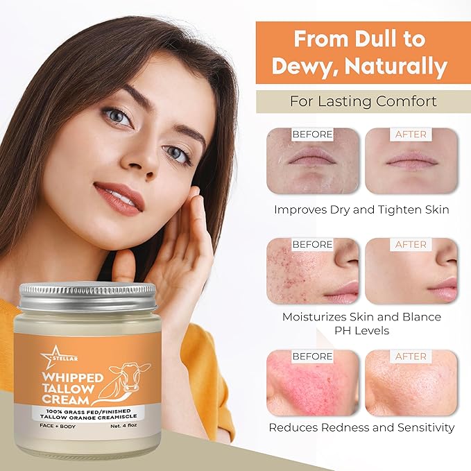 Beef Tallow Cream for Face & Body – 100% Grass-Fed Beef Tallow Skin Care Moisturizer | Whipped Tallow Face Moisturizer for Dry, Sensitive, Aging Skin | Natural Tallow Balm | 4 oz (Orange)