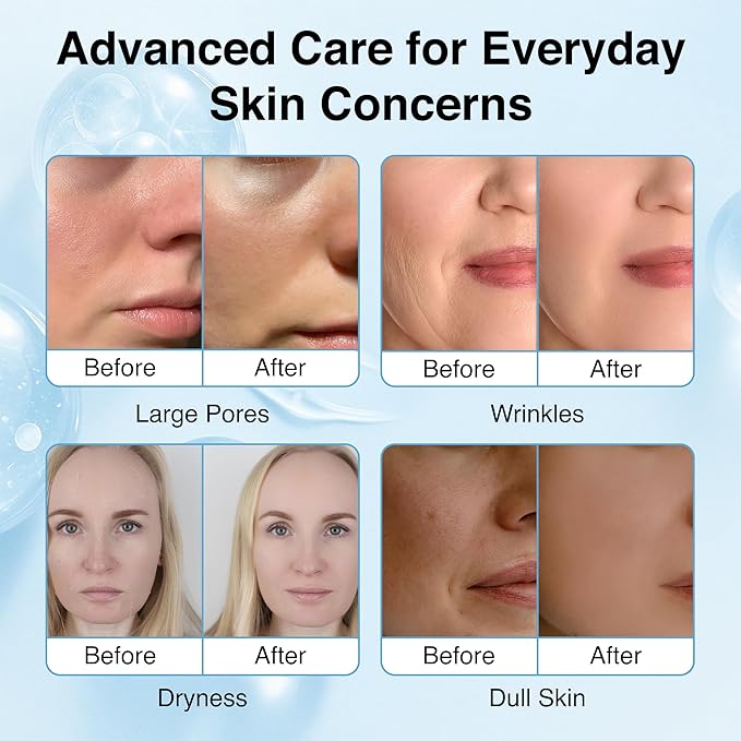 Collagen Face Mask - 6 Pack, Hydrating & Firming Sheet Mask for All Skin Types, Anti-Wrinkle, K-Beauty & Moisturizing Overnight Skincare